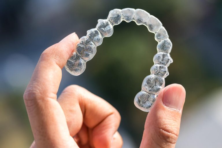 Aparaty Invisalign – najnowoczesniejsze aparaty ortodontyczne na rynku (2)