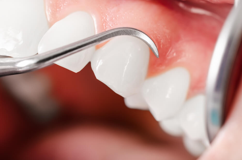 periodontolog Warszawa