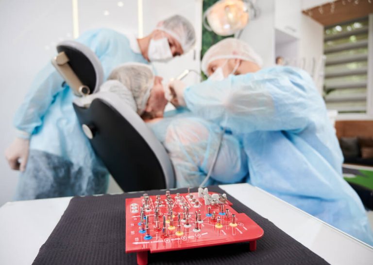 wszczepianie implantów zębowych