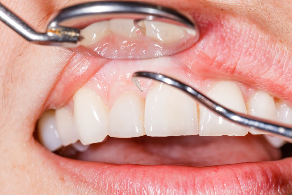 periodontologia