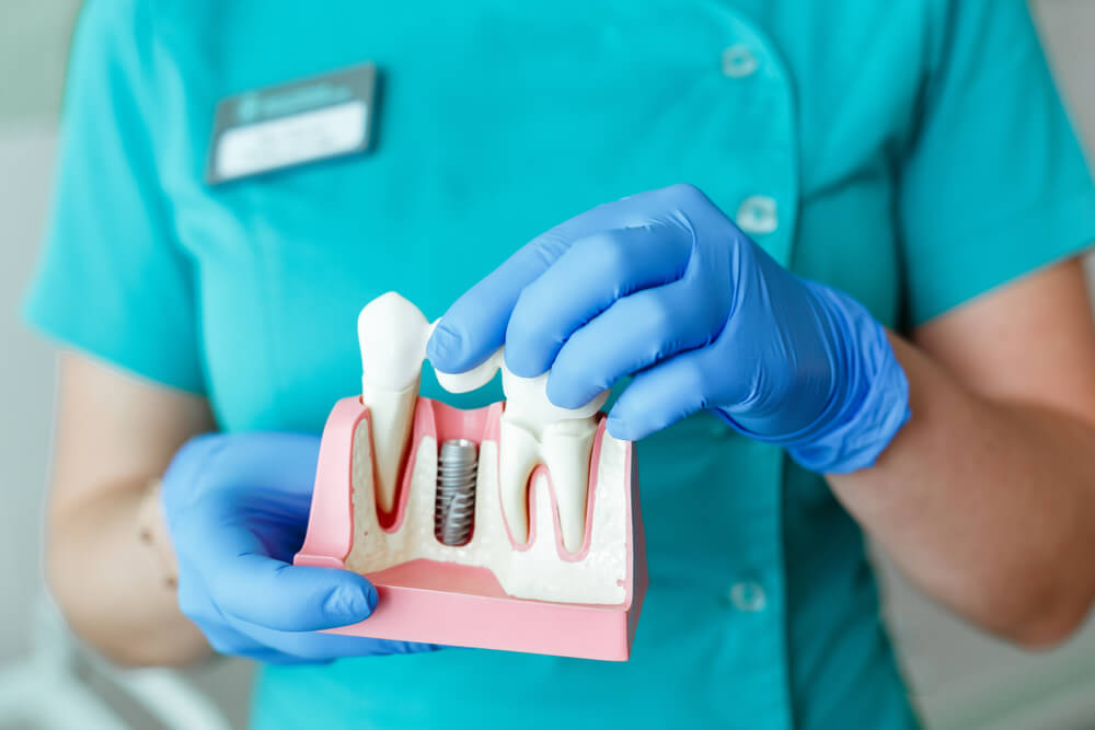 wstawienie implantu