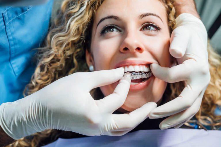 invisalign